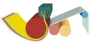extrusion-coated-market