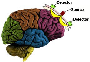 near-infrared-spectroscopy-market