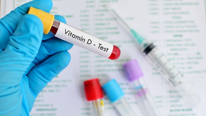 vitamin d testing market
