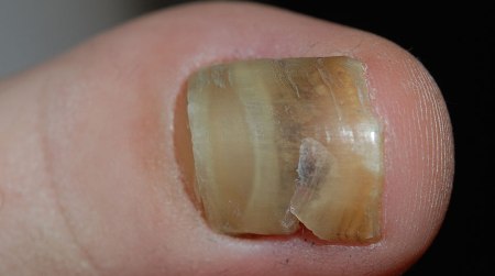 Worldwide Market Reports