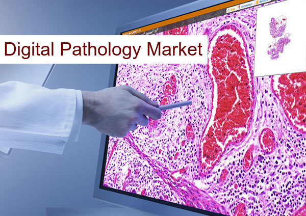 Digital Pathology Market
