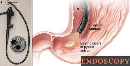 Worldwide Market Reports