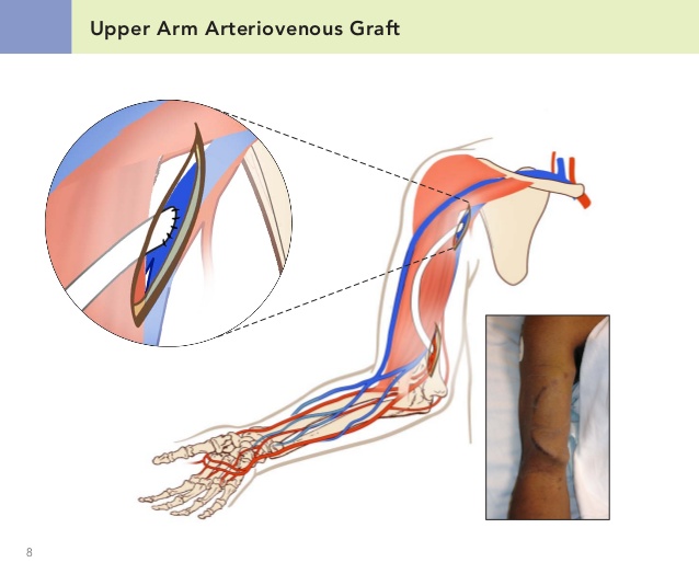 Worldwide Market Reports