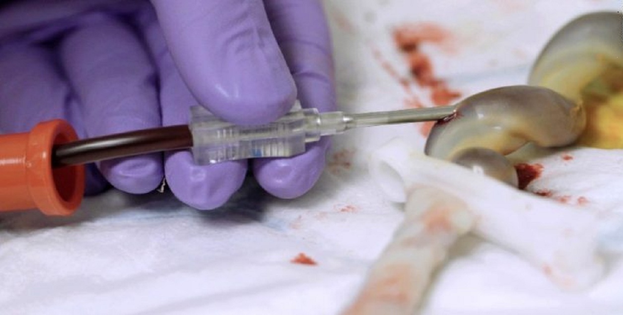 Cord Blood Stem Cells