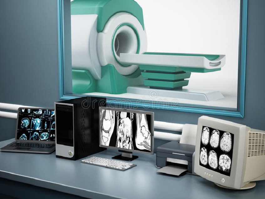 MRI (Magnetic Resonance Imaging System)