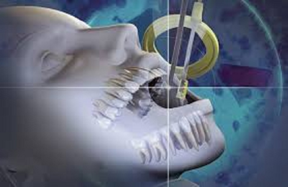 Pallet Pooling System Dental