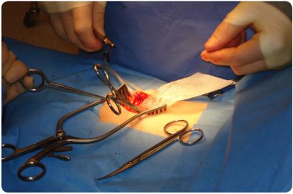 Soft Tissue Repair Equipment