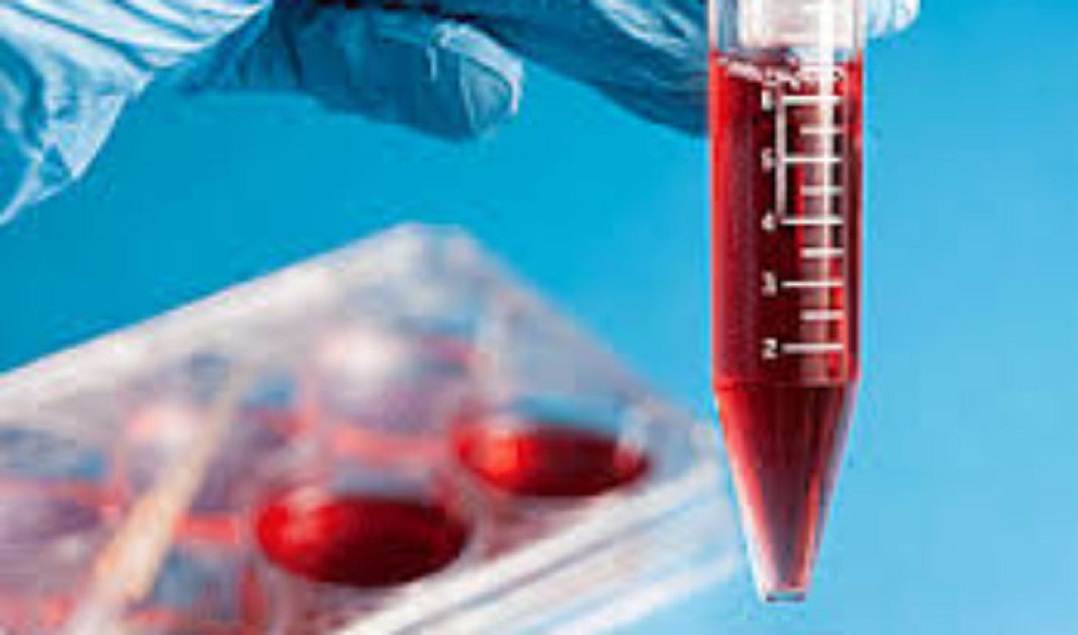 Stem Cells Cryopreservation Equipments
