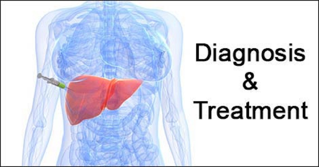 Liver Cancer Diagnostic Tests