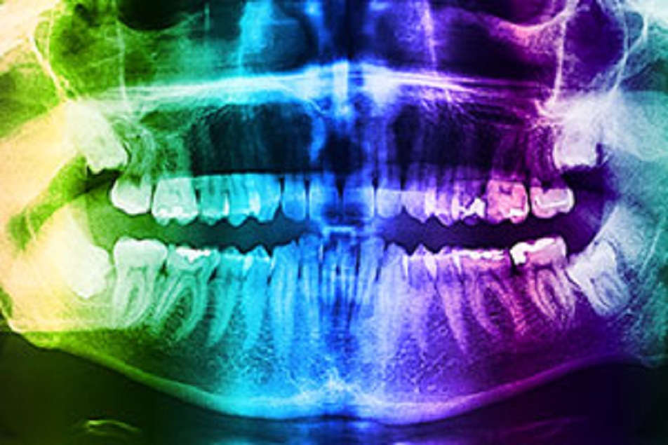 Photo-Imaging Chemicals